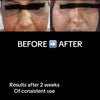 Natural Retinol Alternative Face Oil - Smoother, softer, more radiant-looking skin - without the Retinol drama
