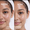 The Clarity Collection - a clam, 3-step system for breakouts and texture